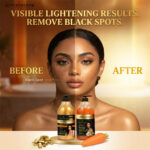 Golden Lightening Shower Gel For Black Spot - Image 2